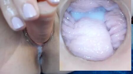 Câmara de Vaginas